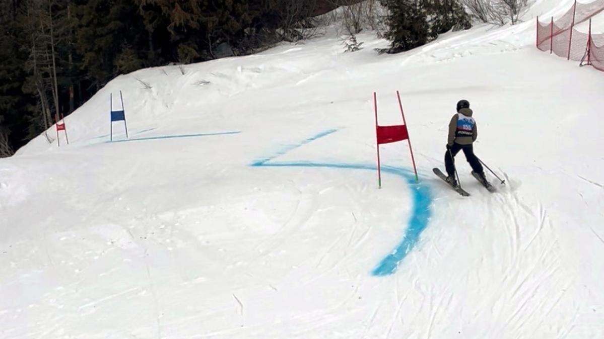 A youth skier races down a treed slope in an alpine downhill race